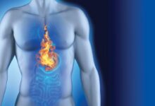 أطعمة مفيدة لمرضى ارتجاع المريء 6 أطعمة مفيدة لمرضى ارتجاع المريء